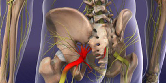 Sciatica Care San Ramon