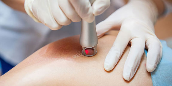 Cold Laser treatment at Canyon Chiropractic in San Ramon